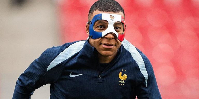 La máscara de Mbappé ¿De qué está hecha y cómo es la protección?